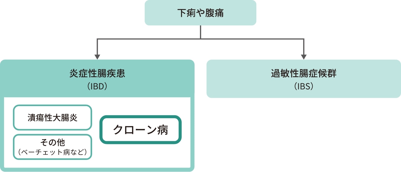 炎症性腸疾患(IBD)の分類