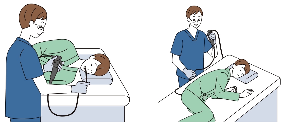 小腸内視鏡検査のイメージ