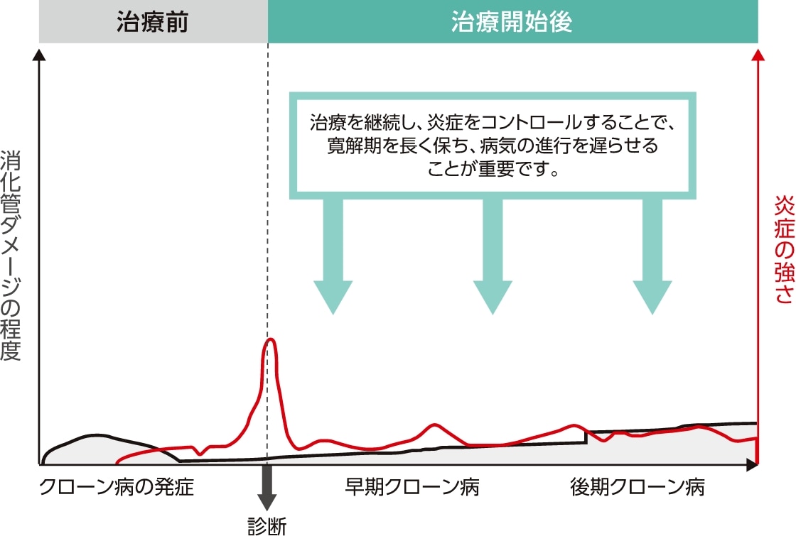 治療による炎症のコントロールのイメージ図