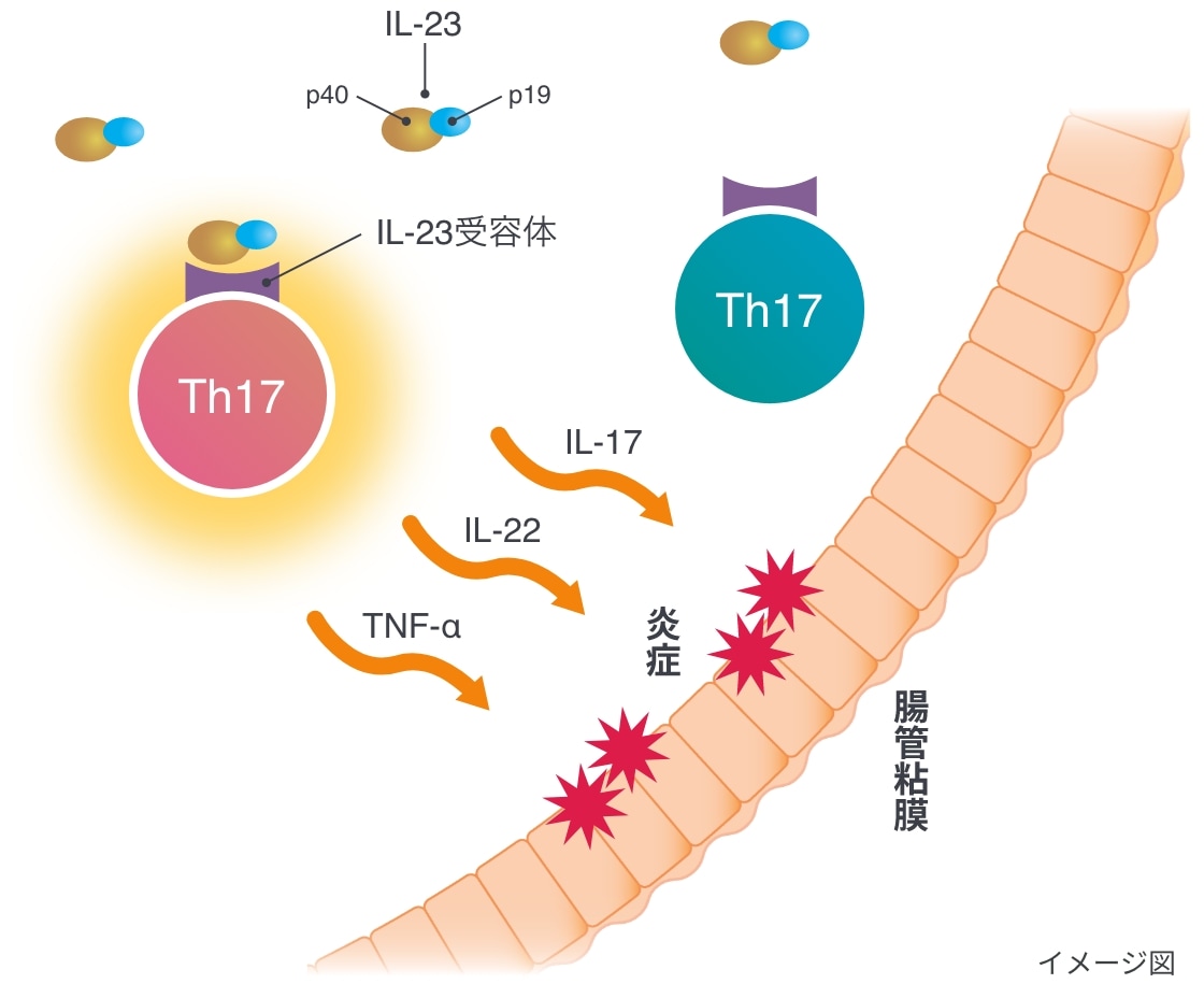 クローン病の炎症が起こるしくみのイメージ図